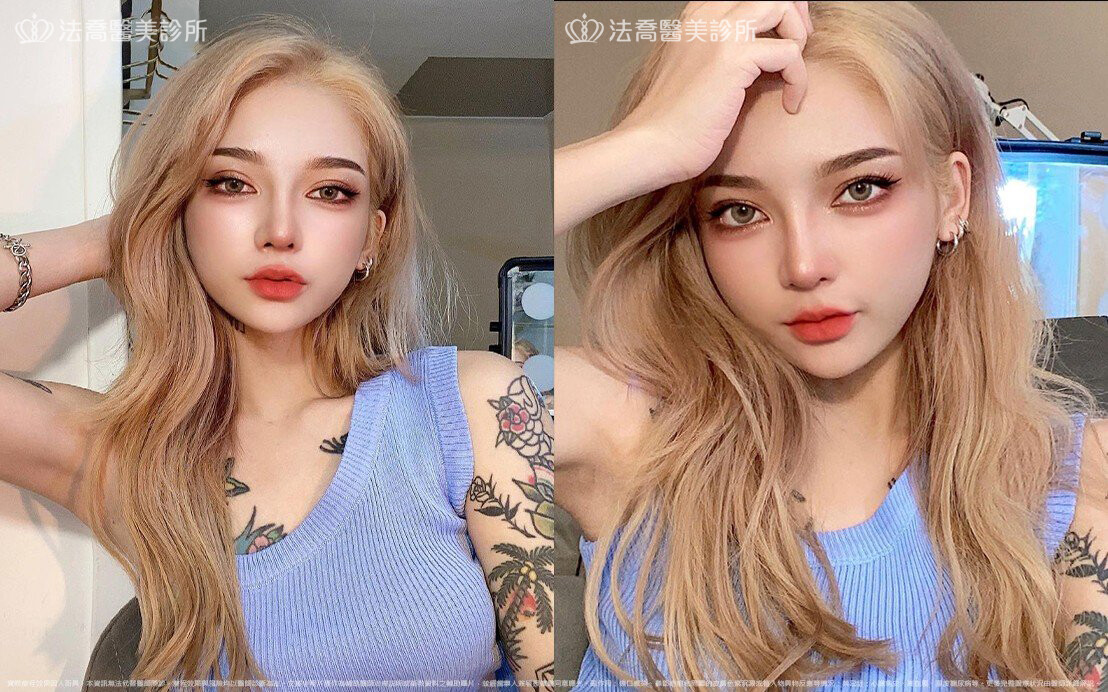 羅志祥 術後7個月生活照