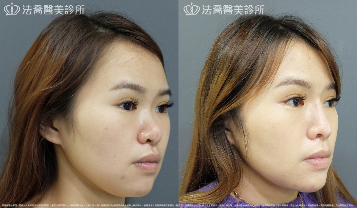 法喬醫美診所 邱浚彥醫師