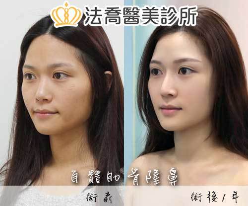 法喬醫美診所 邱浚彥醫師