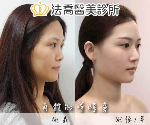 法喬醫美診所 邱浚彥醫師