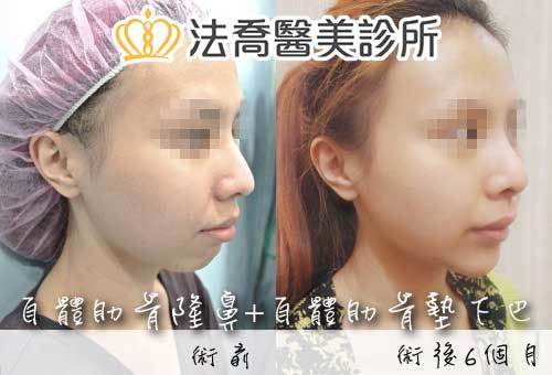 法喬醫美診所 邱浚彥醫師