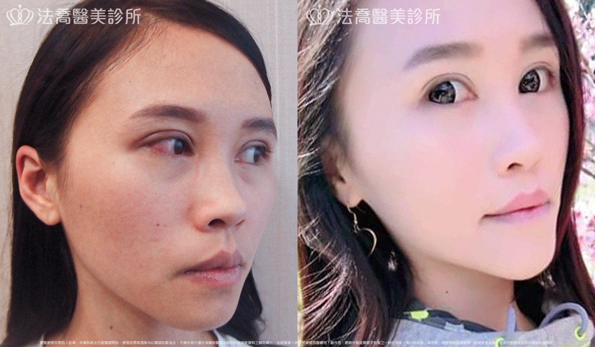 法喬醫美診所 邱浚彥醫師