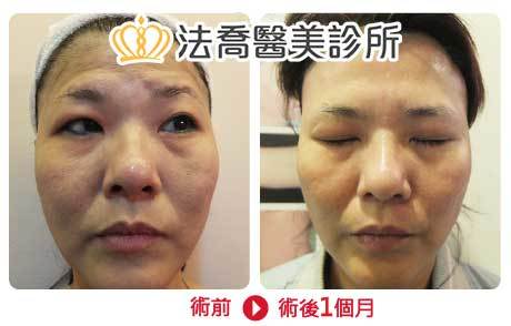 法喬醫美診所 邱浚彥醫師