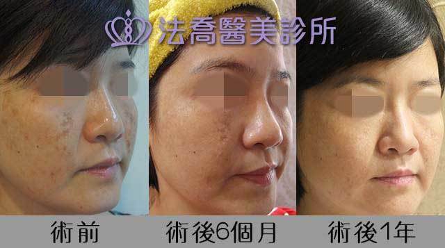 法喬醫美診所 邱浚彥醫師