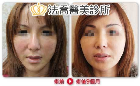 法喬醫美診所 邱浚彥醫師