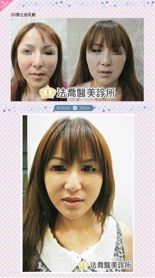 法喬醫美診所 邱浚彥醫師