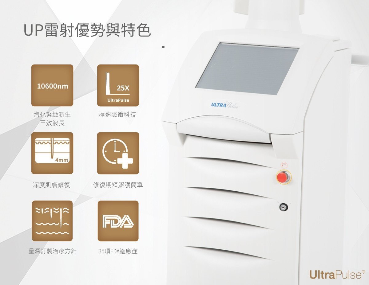 UP雷射優點