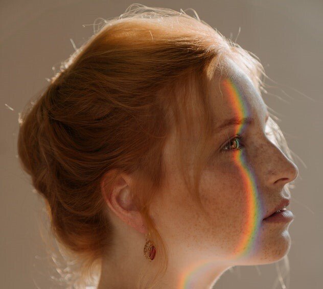 色素斑如何預防及治療