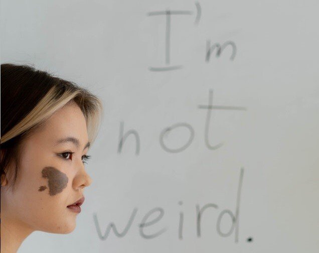 這是胎記,我不奇怪!