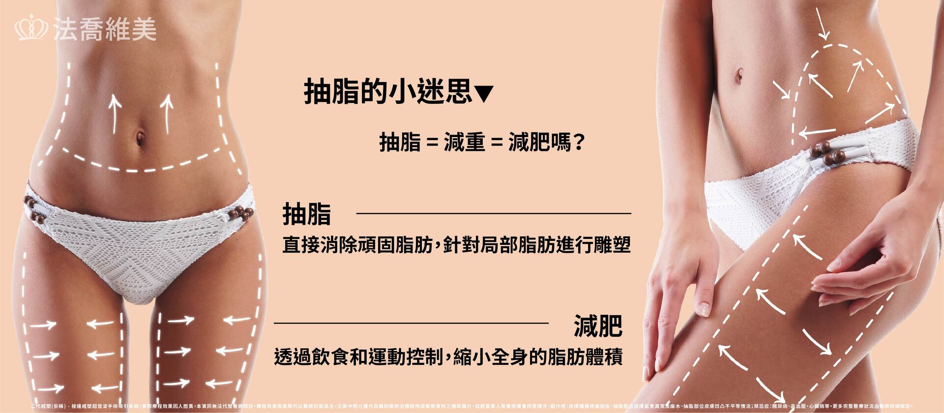 法喬威塑抽脂減肥減重