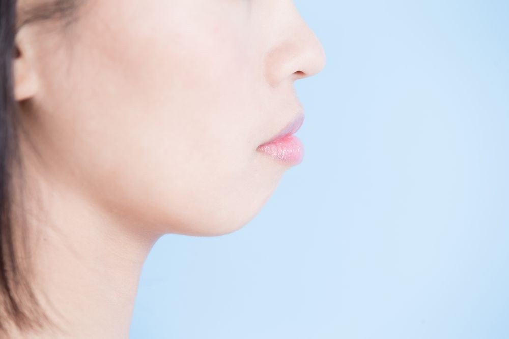 法喬邱浚彥人工骨墊下巴