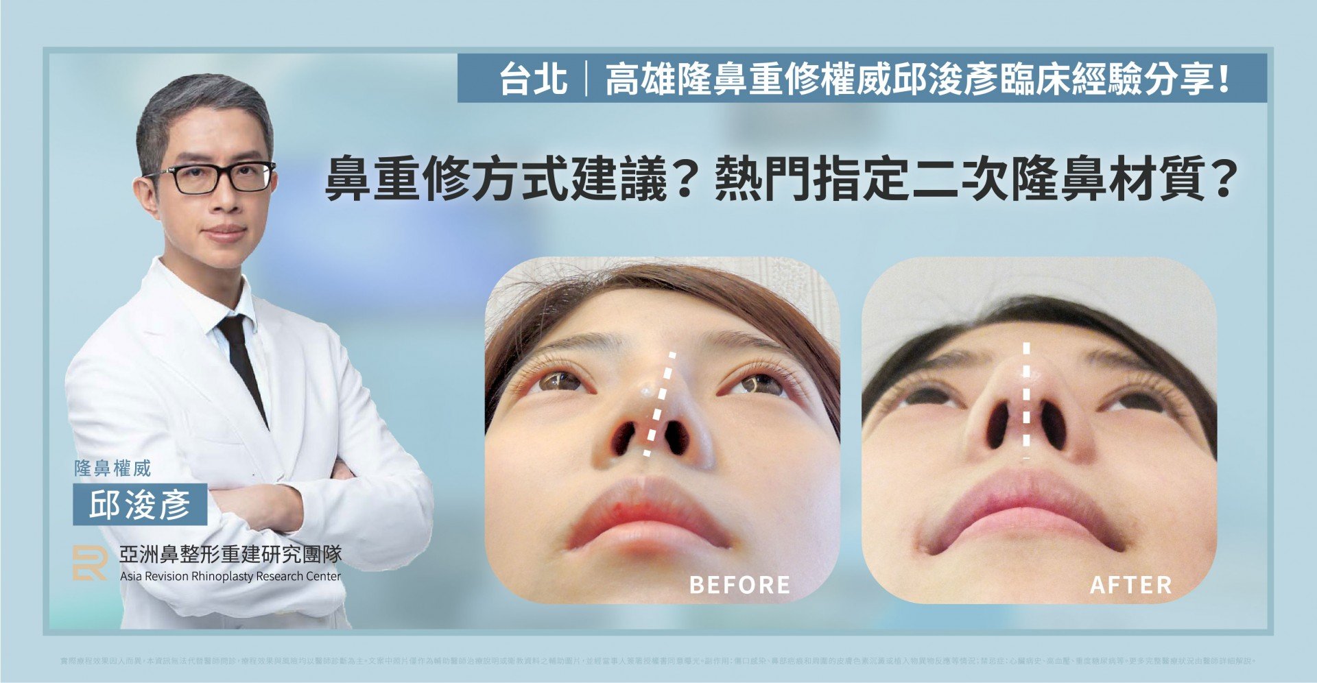 台北高雄二次隆鼻法喬邱浚彥