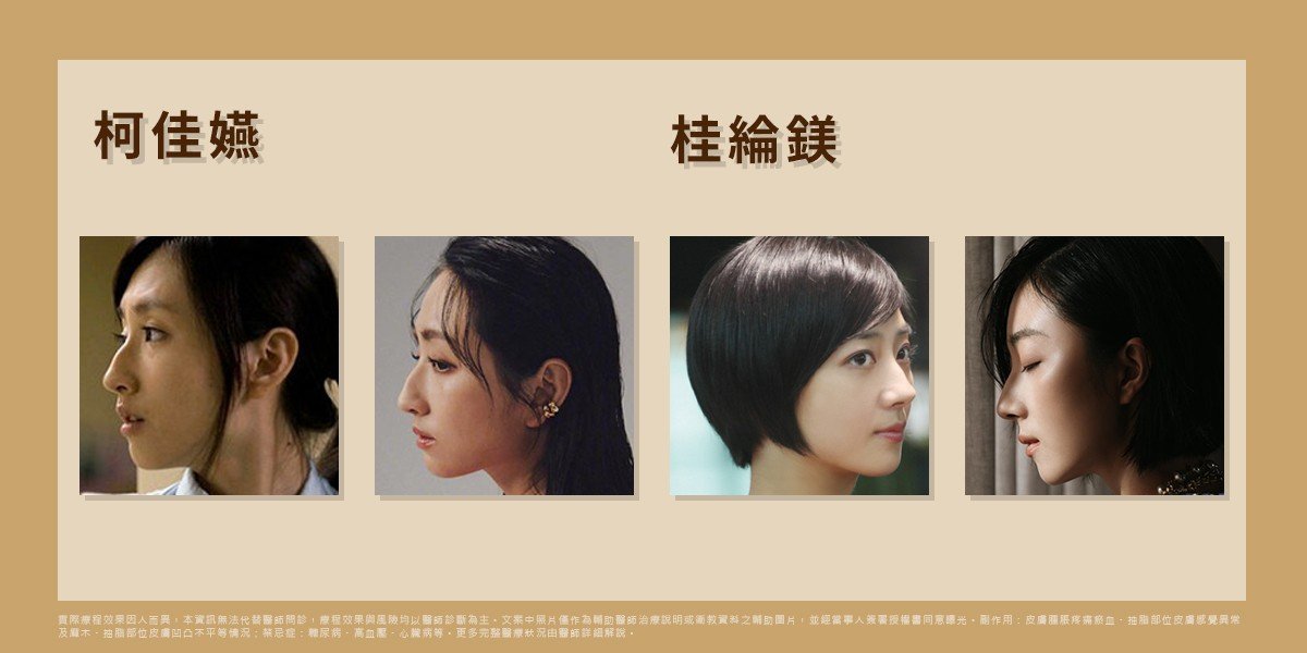 柯佳嬿與桂綸鎂的駝峰鼻