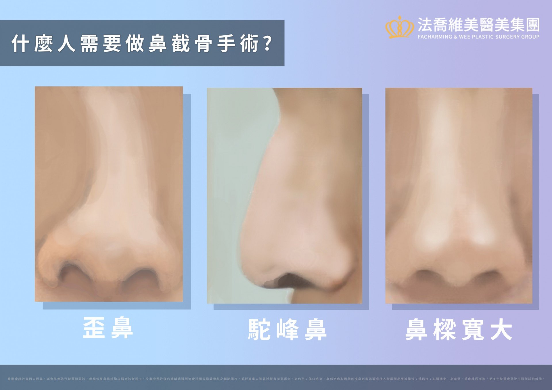 歪鼻,駝峰鼻,鼻樑寬大